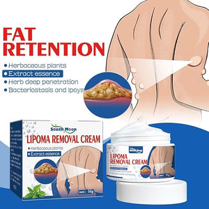 South Moon Lipoma Removal Cream buy one get one free
