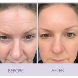 Seoul 1988 Eye Cream +
Celimax Retinal Shot Booster
